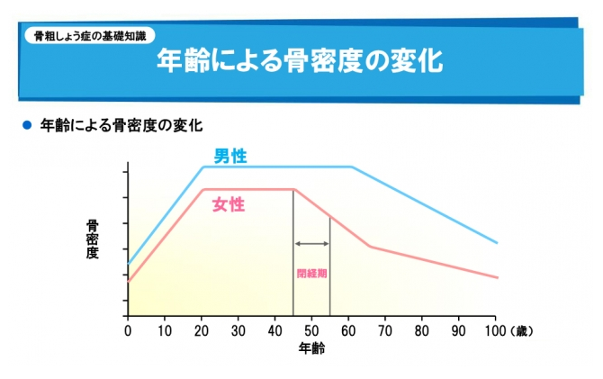 ピラティス