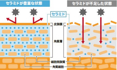 ウーマンNS