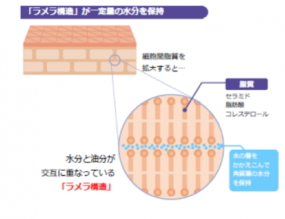 ウーマンNS