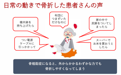 骨粗しょう症