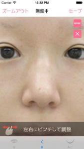 整形マニア